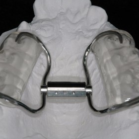 Kieferorthodontie